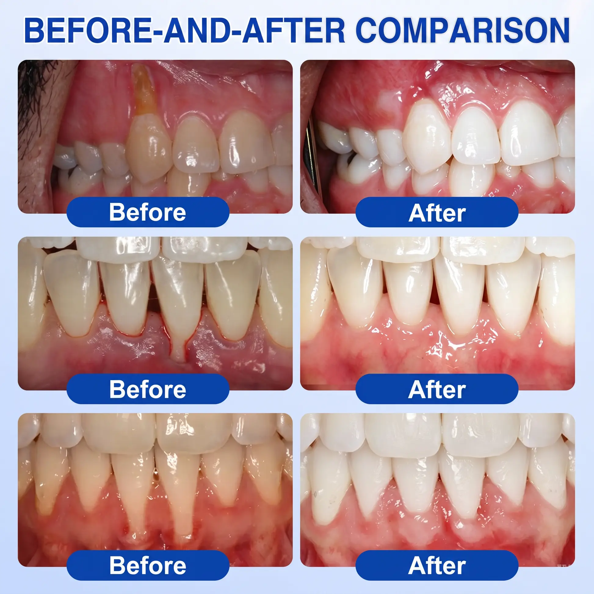 GumRevive Periodontal Repair Gel - Image 3