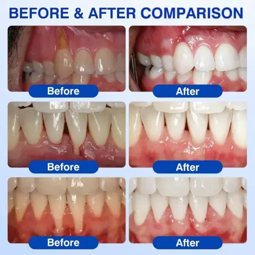 GumRevive Periodontal Repair Gel - Image 3