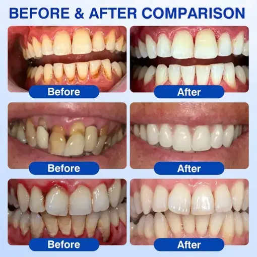 GumRevive Periodontal Repair Gel - Image 4