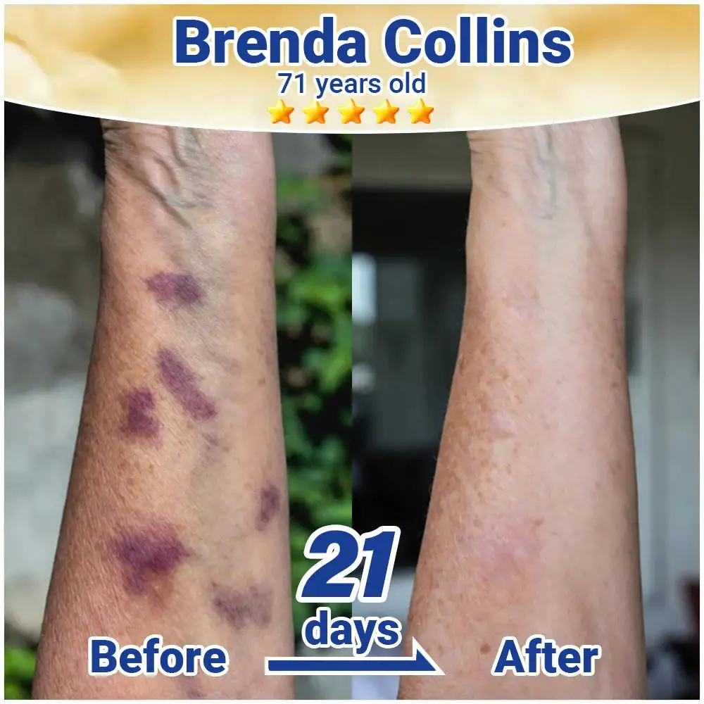 ResiliVeil Bruise Appearance Barrier Care Cream - Image 6