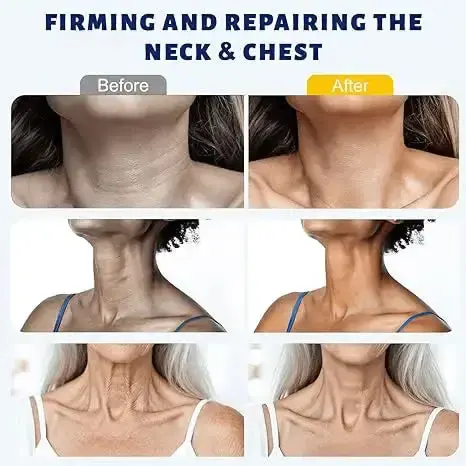 Instant Neck Firming Cream with 5-Ball Roller & Retinol - Image 3