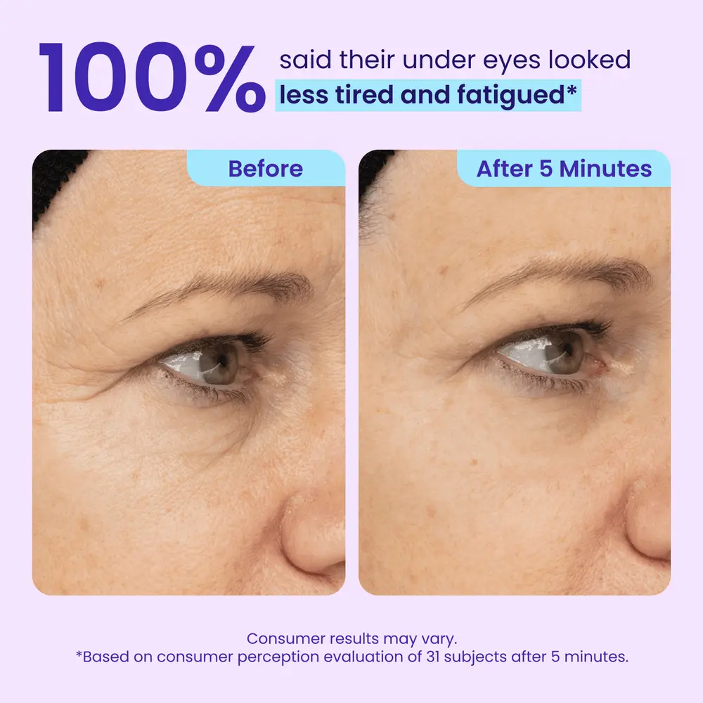 LOVILDS Instant Lift Eye Gel - Image 6