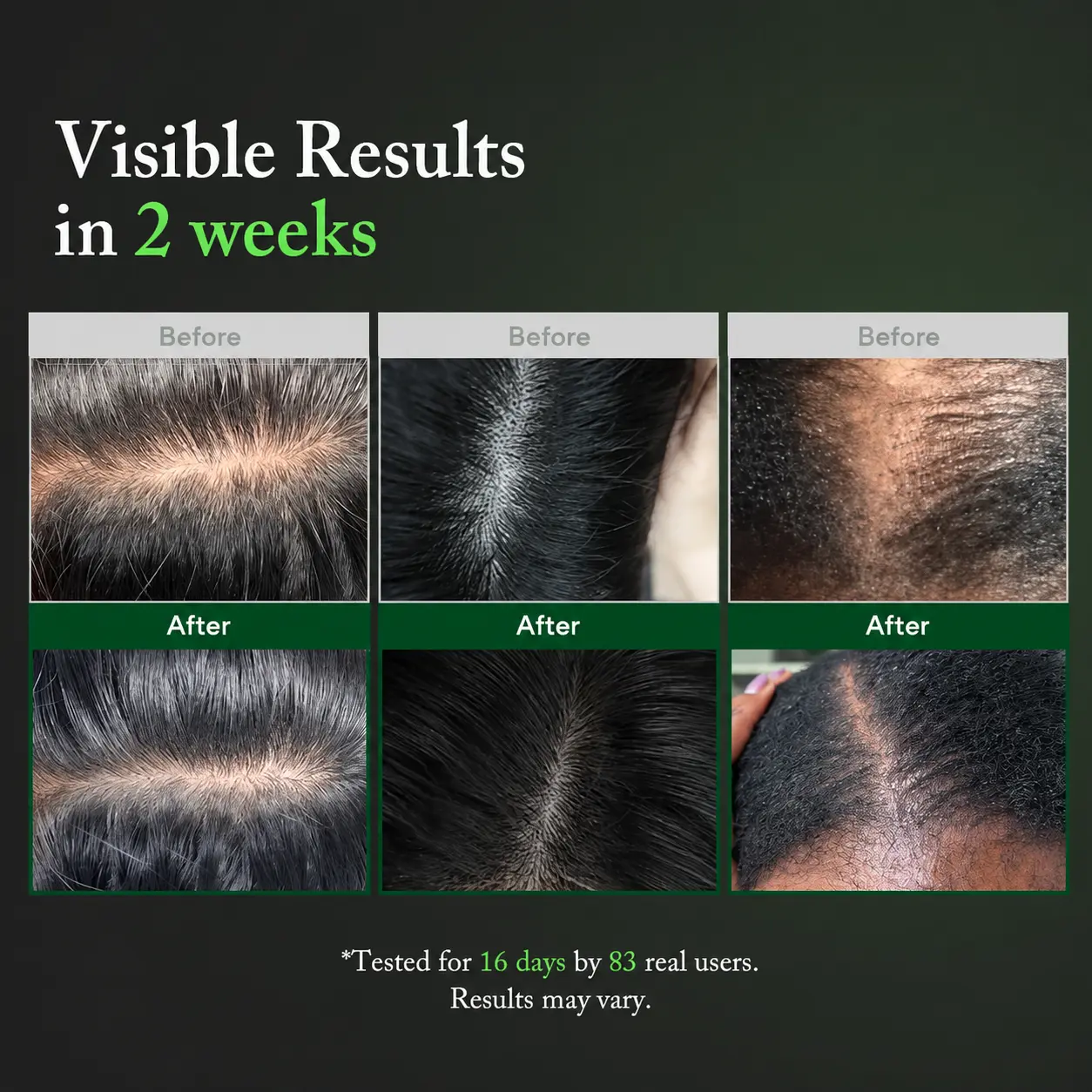 LOVILDS PDRN Scalp Serum - Image 6