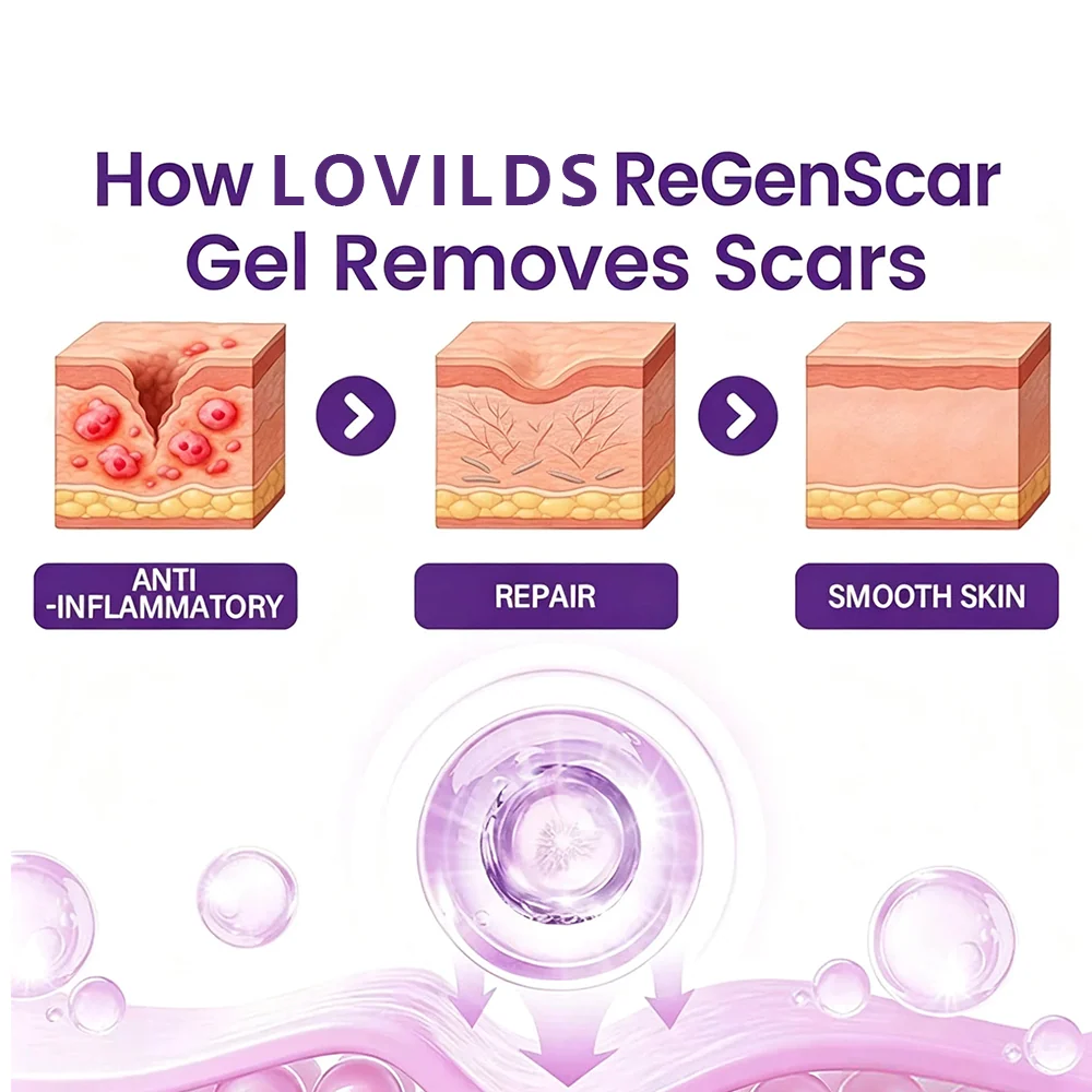 LOVILDS ReGenScar Stem Cell Scar Gel - Image 3