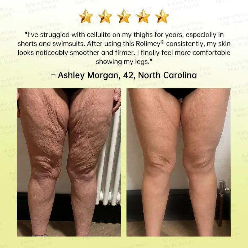 Botox & Multi-Peptide Retinol Shot Wrinkle-Lift Tightening Cream - Image 10