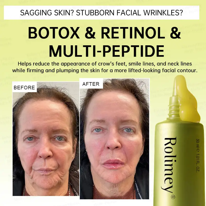 Botox & Multi-Peptide Retinol Shot Wrinkle-Lift Tightening Cream - Image 5