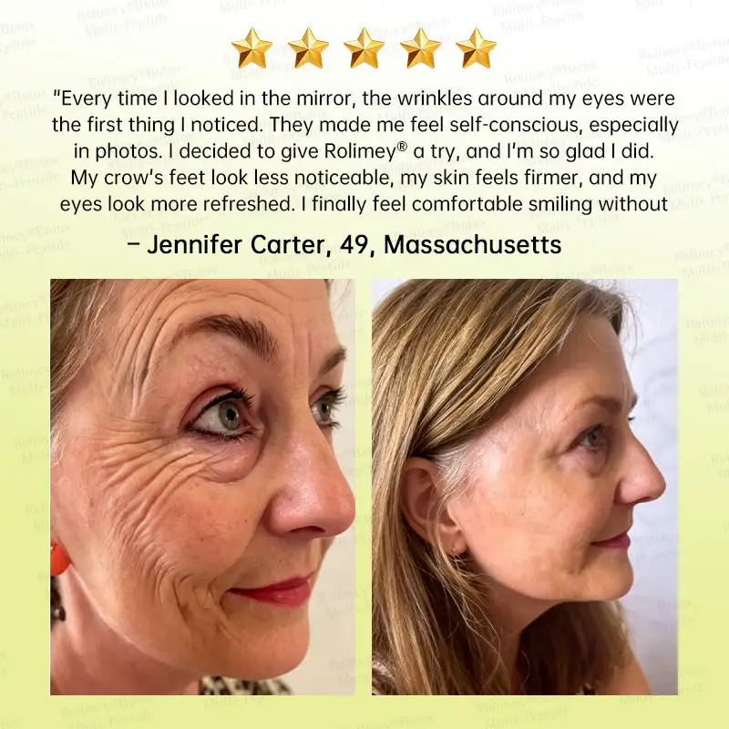 Botox & Multi-Peptide Retinol Shot Wrinkle-Lift Tightening Cream - Image 8