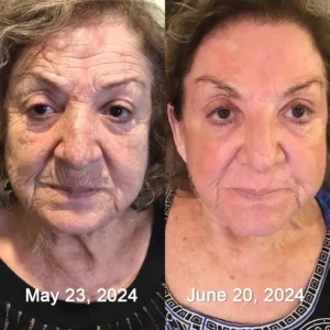 Alternative view of Botox & Vita-A Retinol Shot Wrinkle-Lift Tightening Cream
