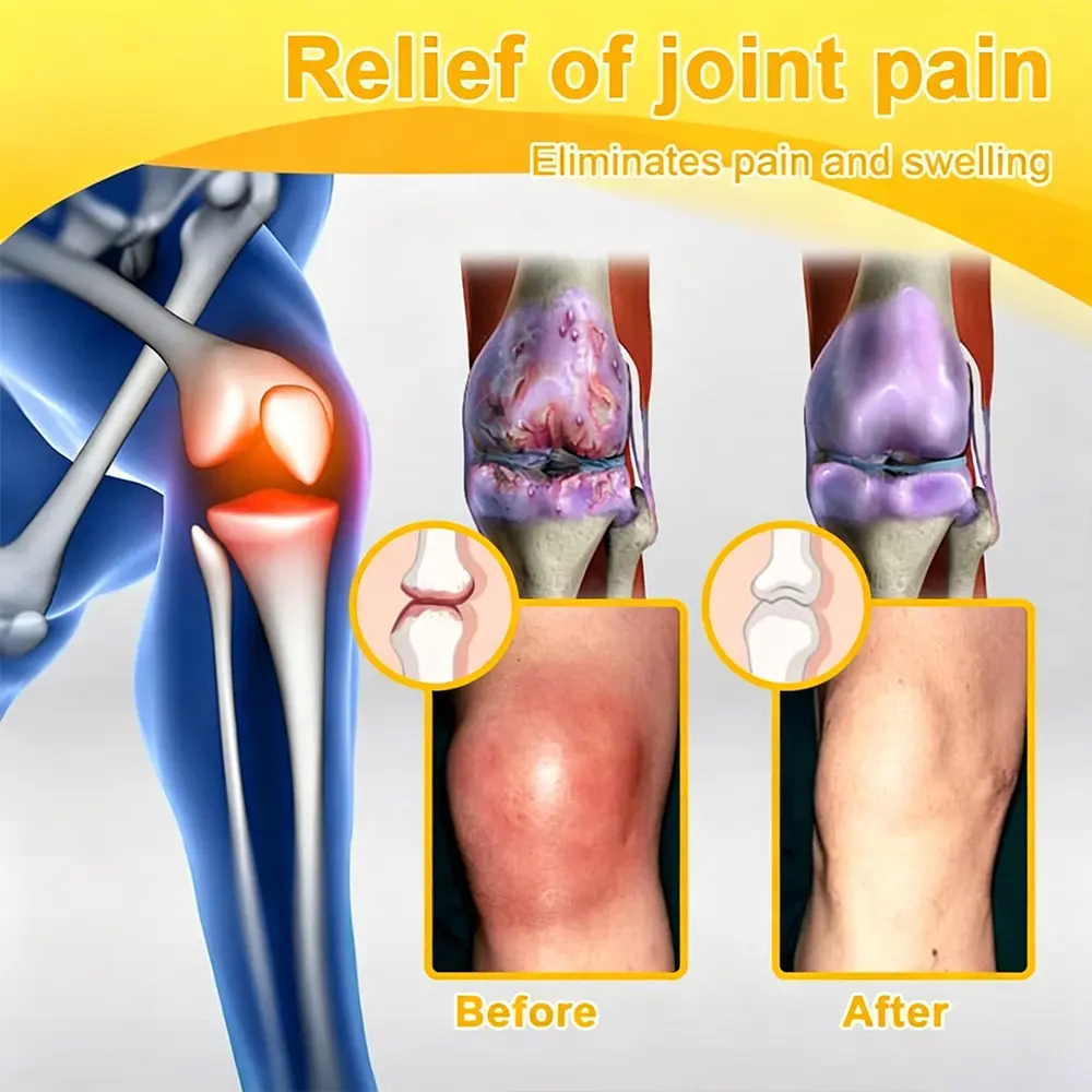 Joint Pain Relief Patches - Image 11