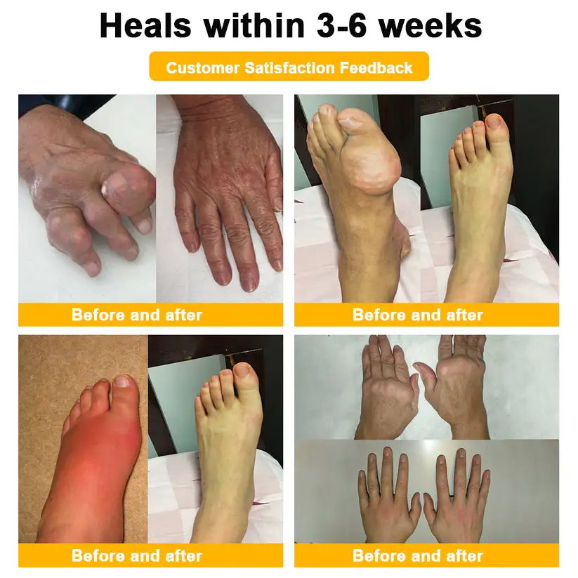 Joint Pain Relief Patches - Image 5