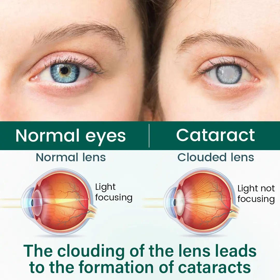OptiClear Nano Eye Roller Serum - Image 6