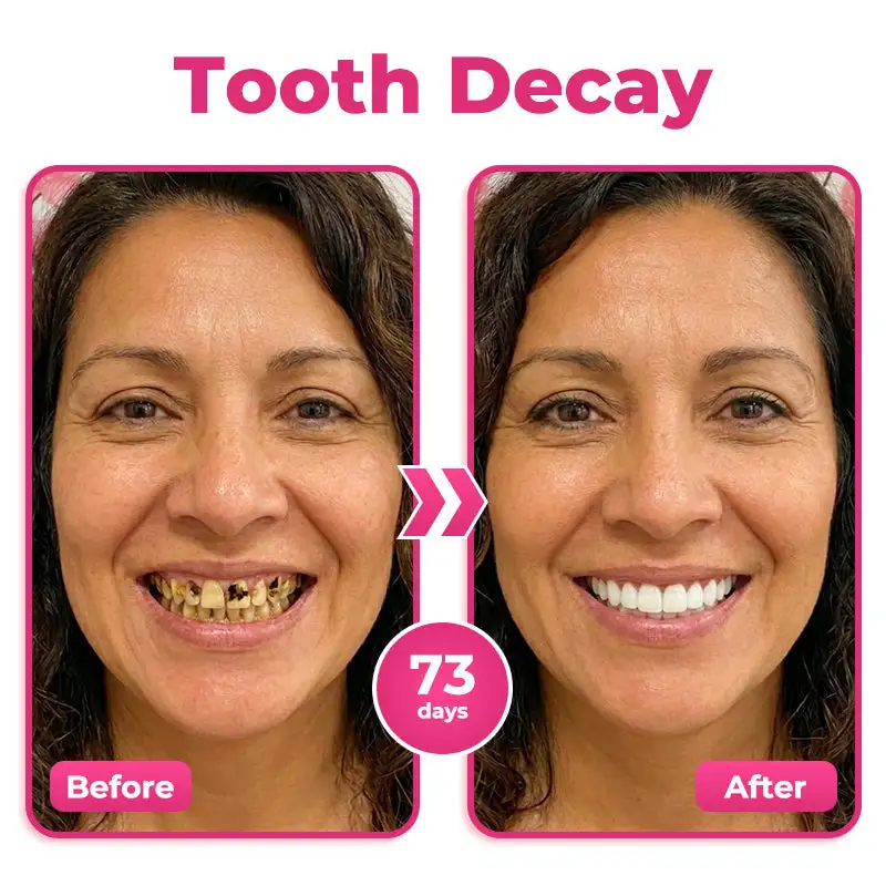 Thismile NH-10 Toothpaste Serum for Enamel & Gum Care - Image 3