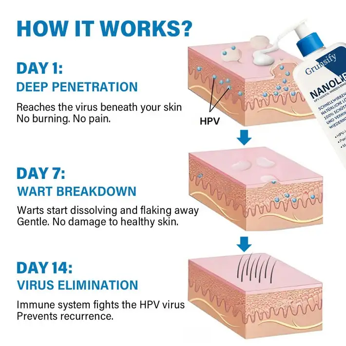 Grunsify NanoLipo HPV Genital Warts Eraser Cream Plus+ - Image 4