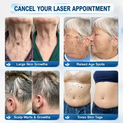 Targeted Skin Tag & Spot Care Cream - Image 2
