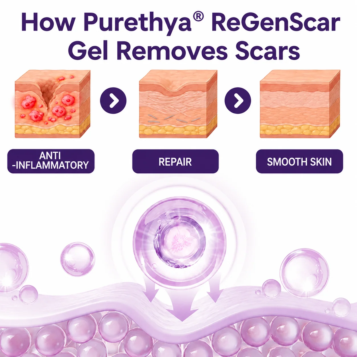 ReGenScar Stem Cell Scar Gel - Image 3