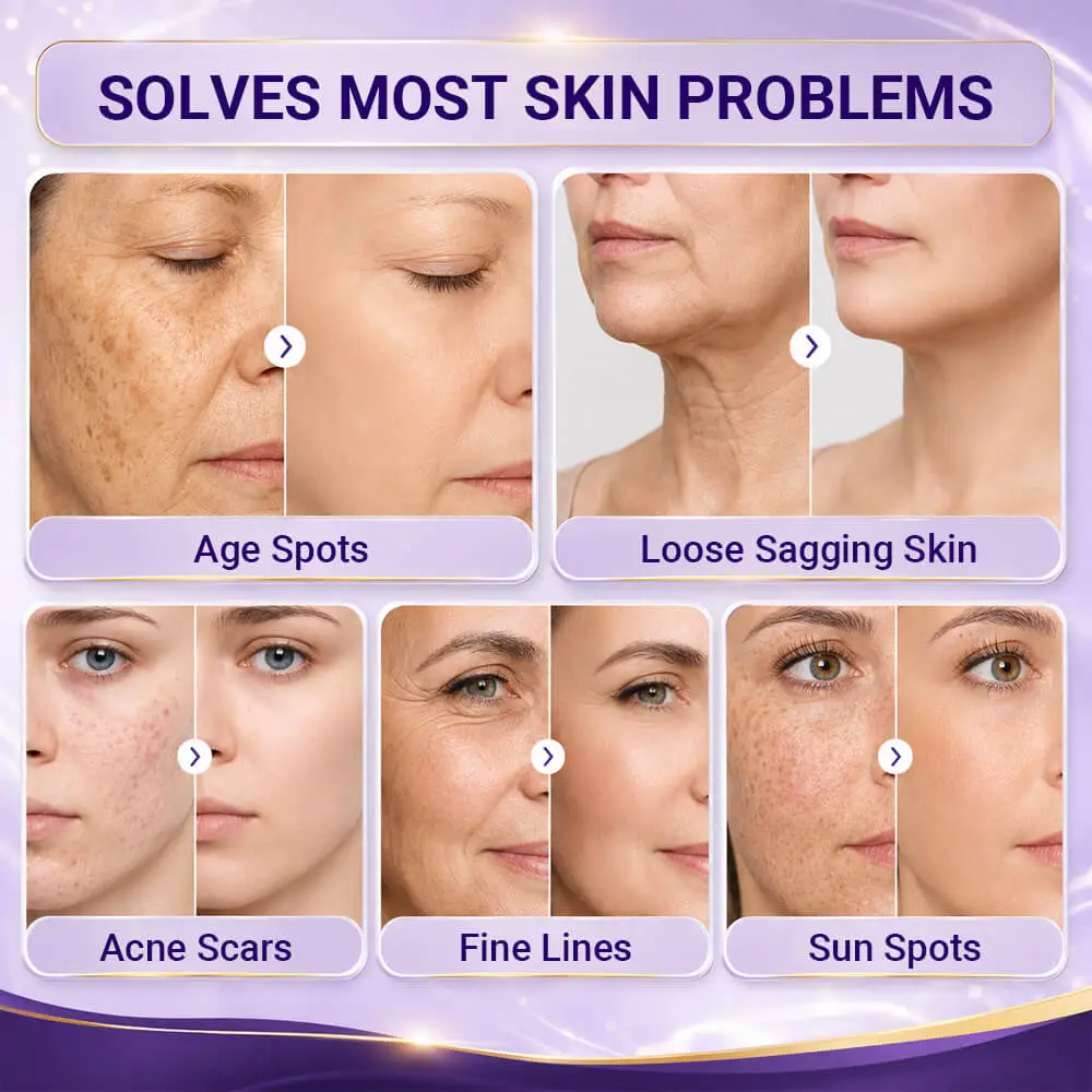 Age Renewal Dark Spot Serum - Image 3