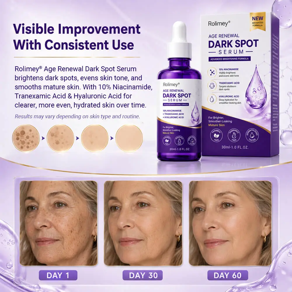 Age Renewal Dark Spot Serum - Image 4
