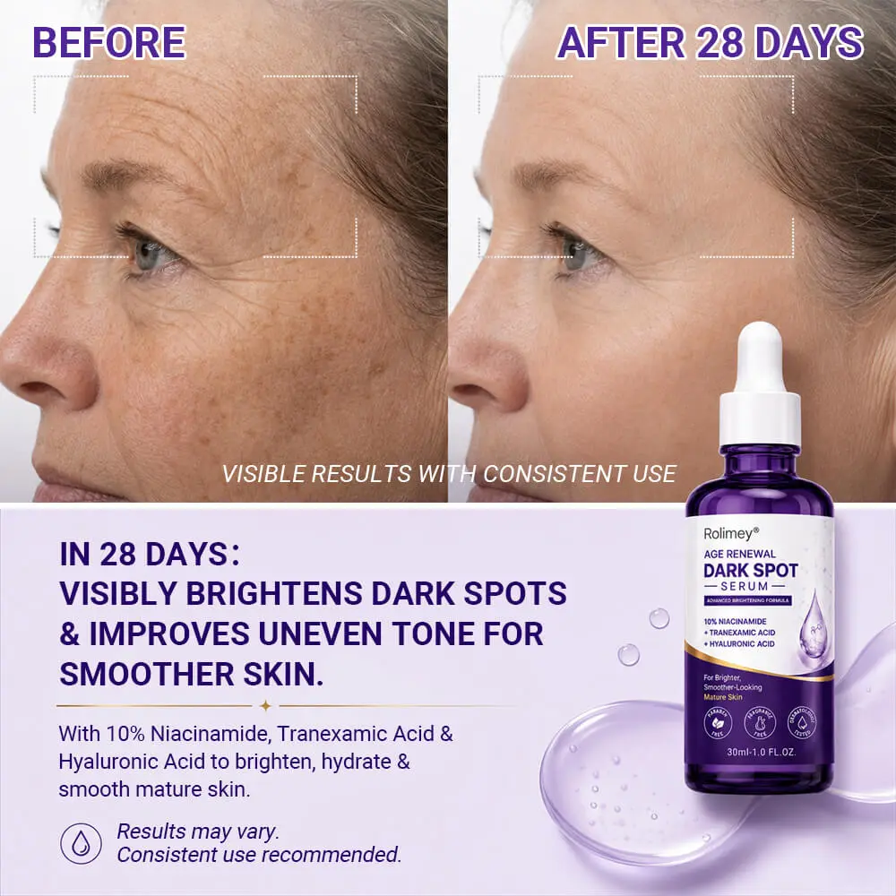 Age Renewal Dark Spot Serum - Image 5