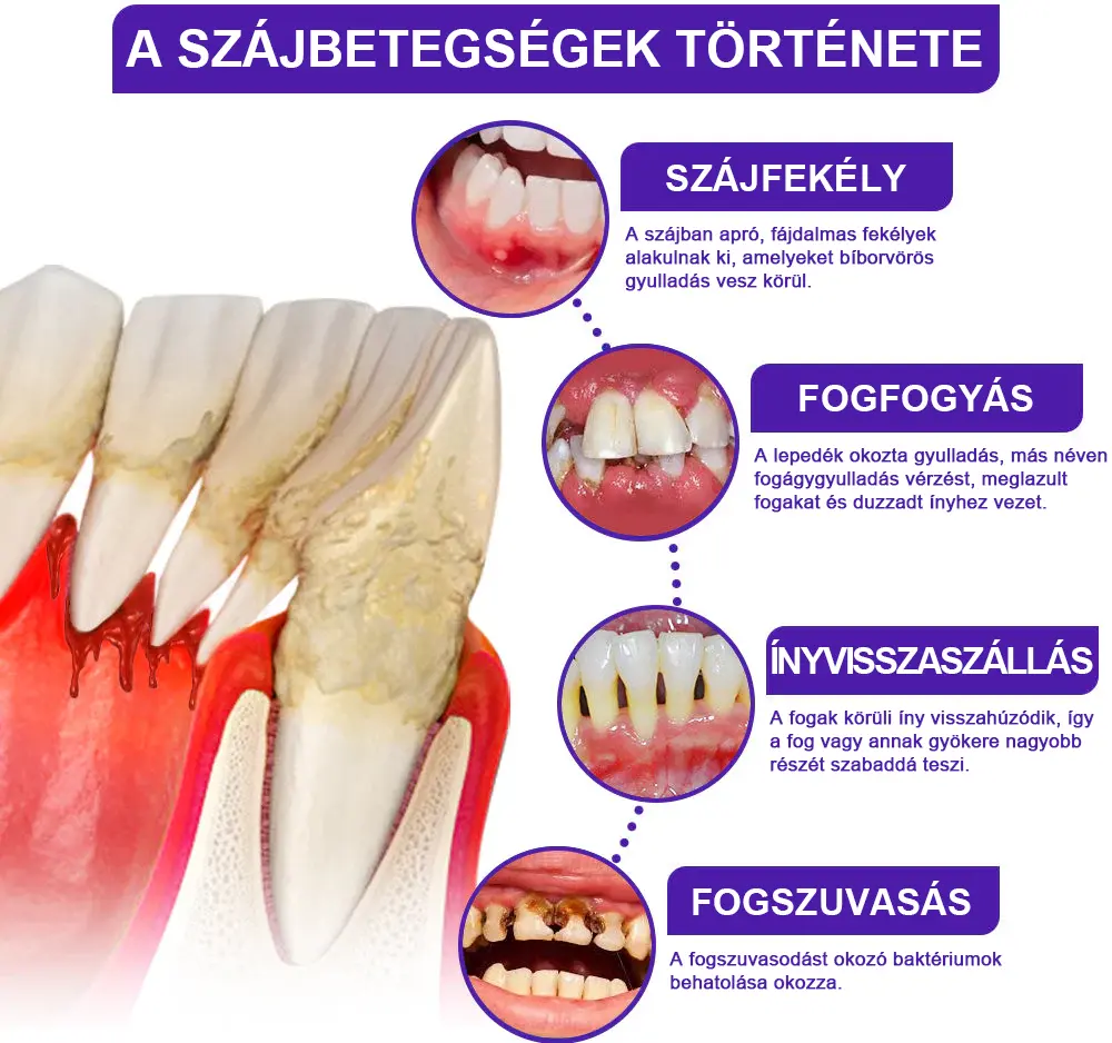 VioCore Méhméreg Fogkezelő Fogkrém - Image 5