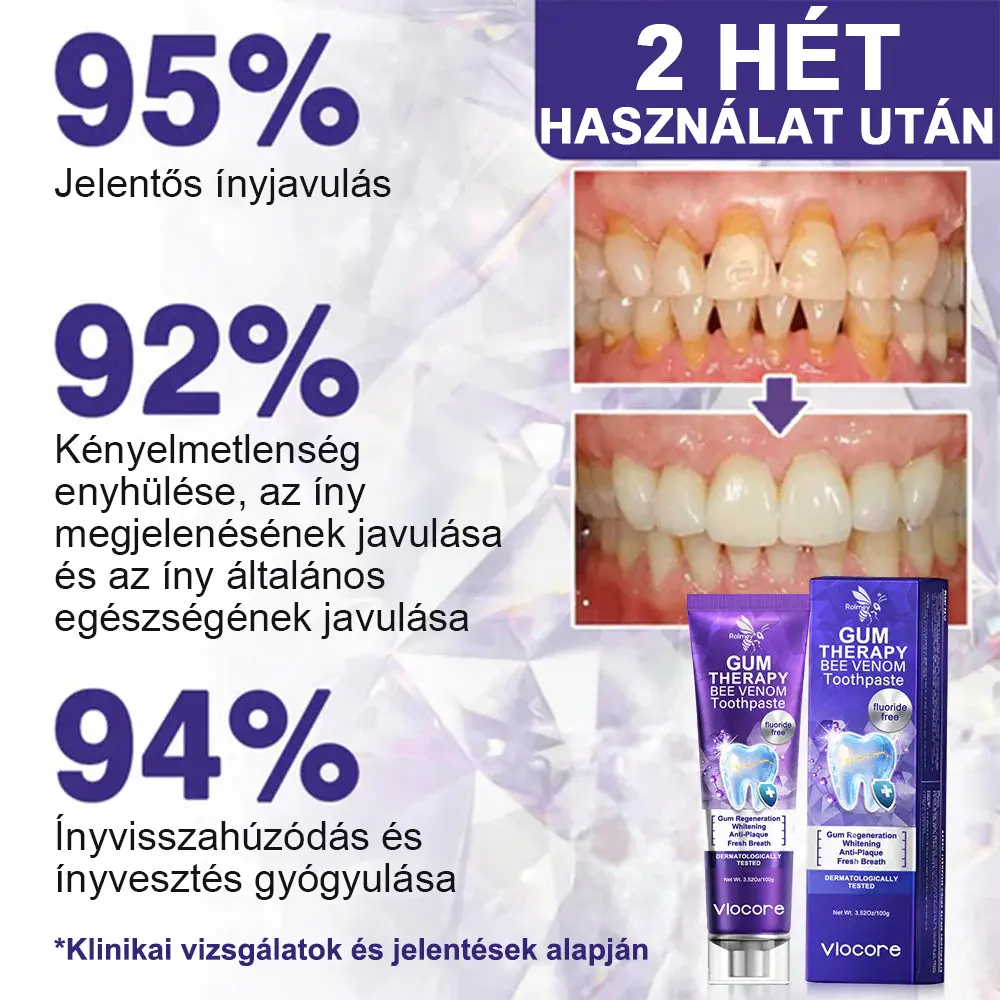 VioCore Méhméreg Fogkezelő Fogkrém - Image 7