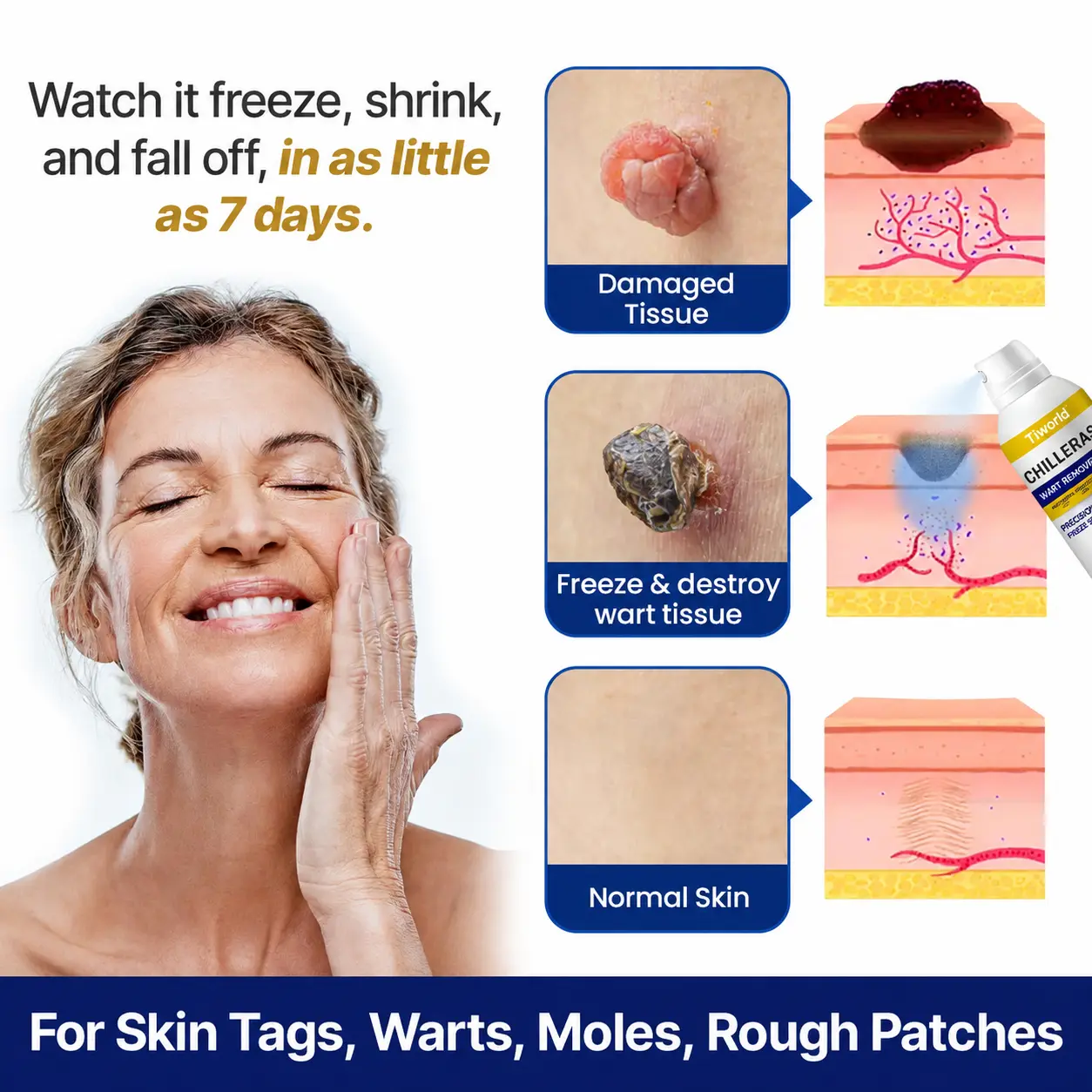 Bump Renewal Spray - Image 6
