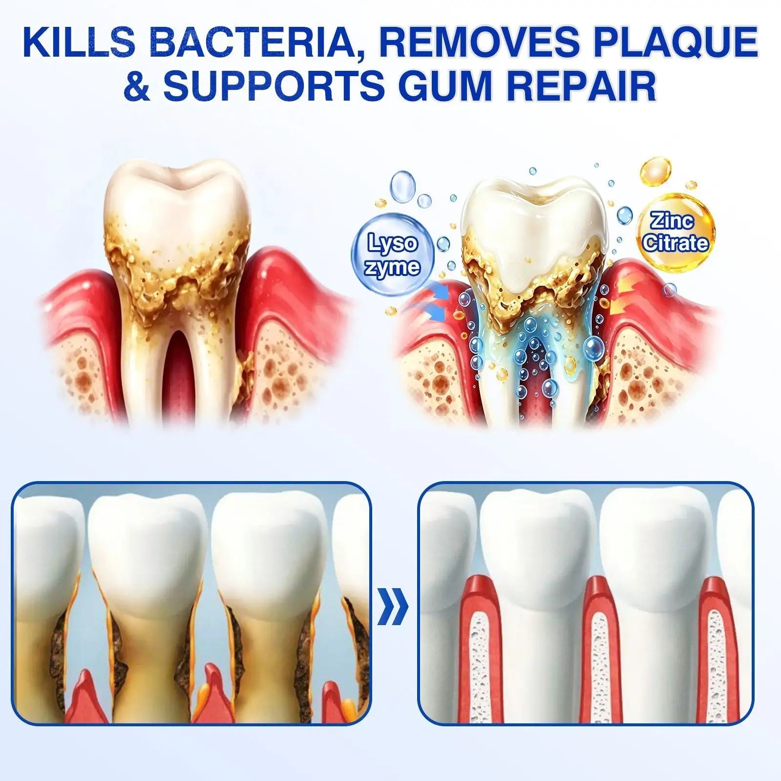Tiworld ® Gum health Periodontal Repair Gel - Image 7