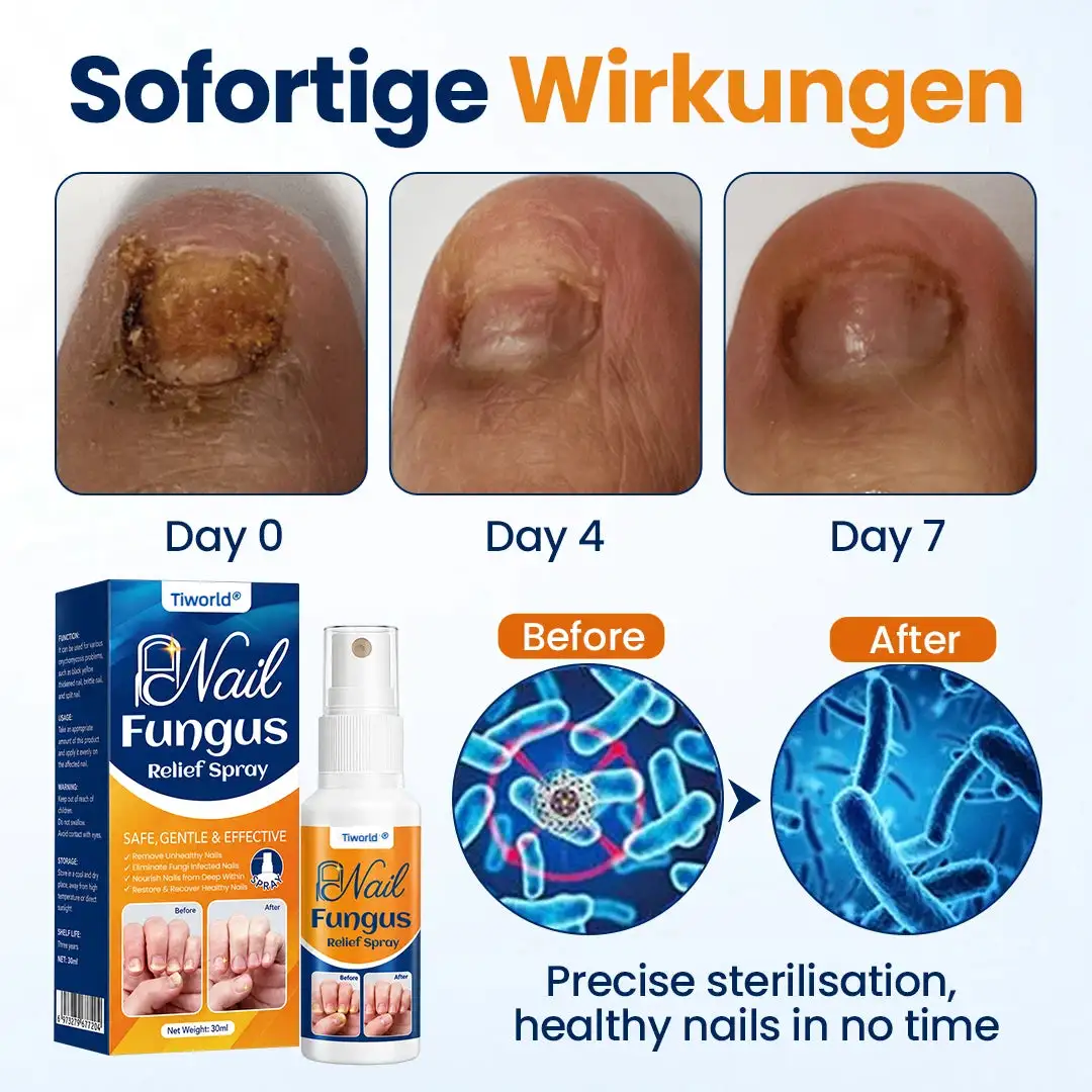 Nail fungus relief spray - Image 3