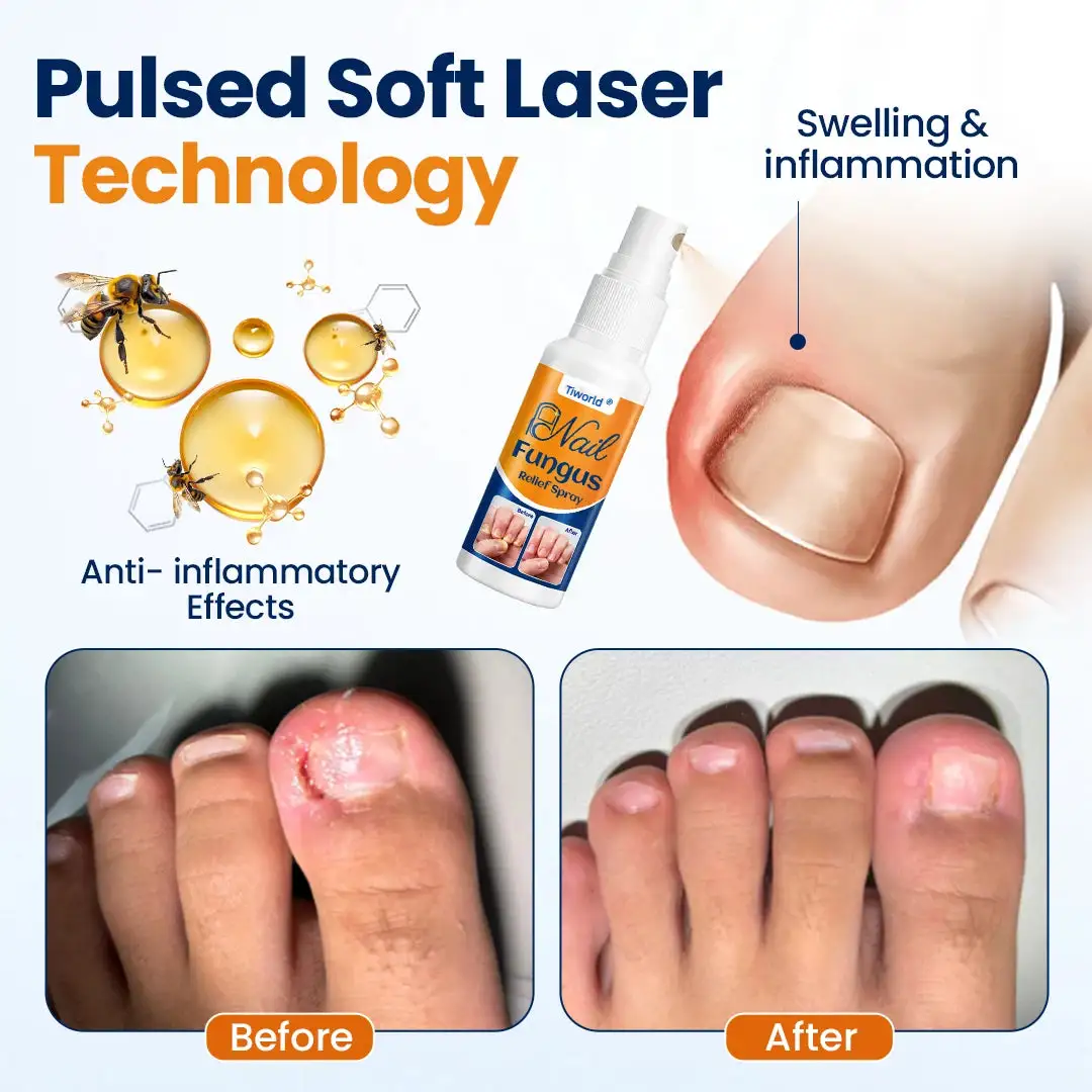 Nail fungus relief spray - Image 5