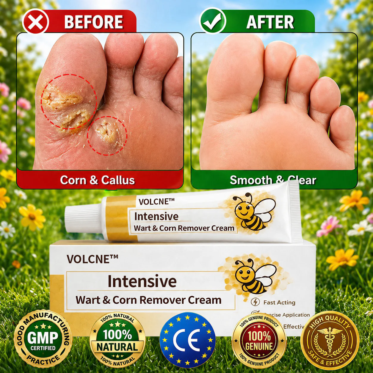 Intensive Wart & Corn Remover Cream
