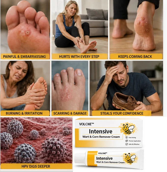 Intensive Wart & Corn Remover Cream - Image 6