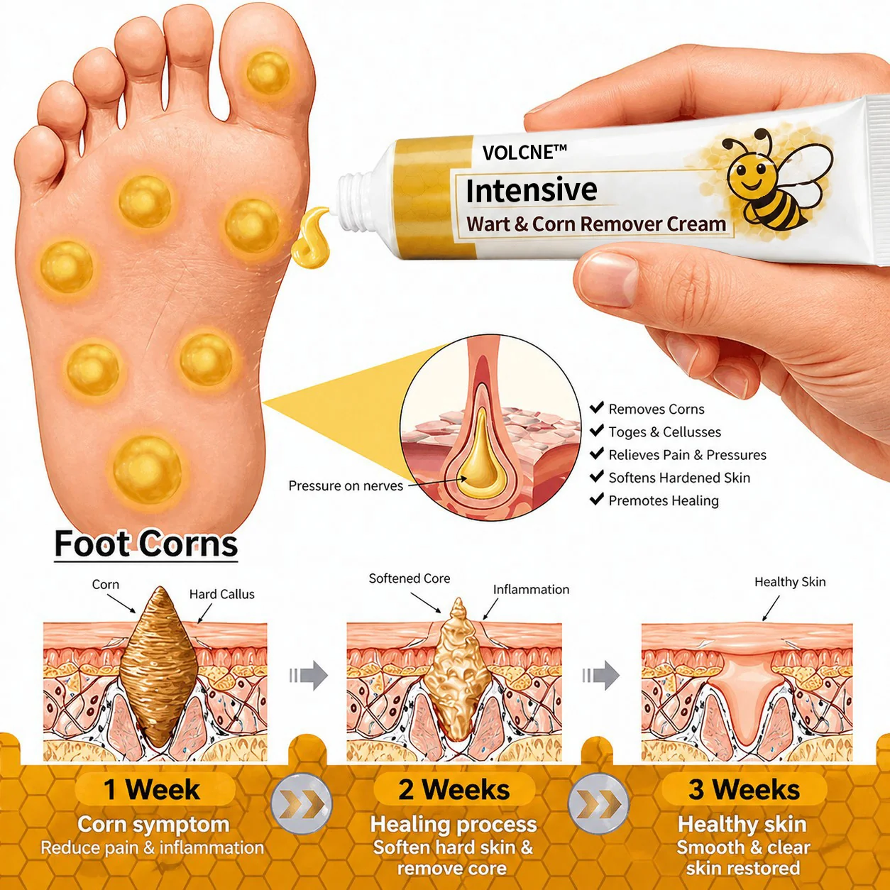 Intensive Wart & Corn Remover Cream - Image 5