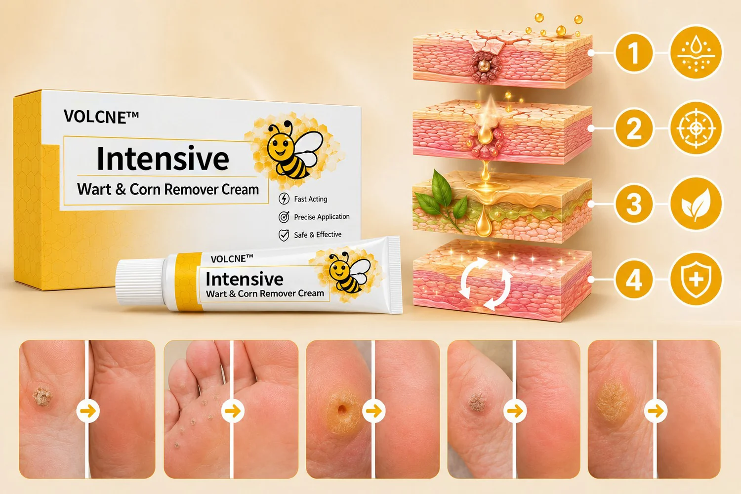 Intensive Wart & Corn Remover Cream - Image 4