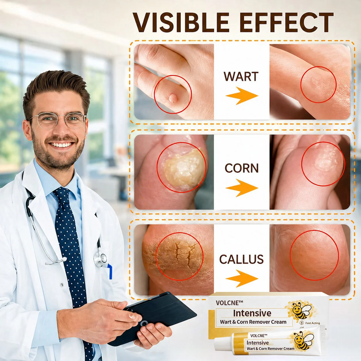 Intensive Wart & Corn Remover Cream - Image 3