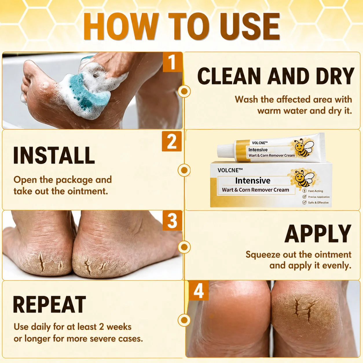 Intensive Wart & Corn Remover Cream - Image 2