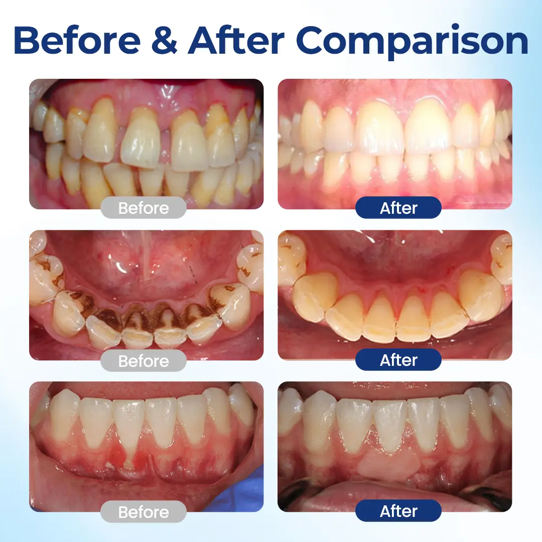 BeeTakt Oral Repair Solution - Image 3