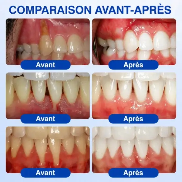 𝑮𝒖𝒎𝑹𝒆𝒗𝒊𝒗𝒆 𝑮𝒆𝒍 𝒅𝒆 𝑹é𝒑𝒂𝒓𝒂𝒕𝒊𝒐𝒏 𝑷𝒂𝒓𝒐𝒅𝒐𝒏𝒕𝒂𝒍𝒆 - Image 12