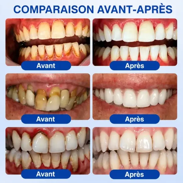 𝑮𝒖𝒎𝑹𝒆𝒗𝒊𝒗𝒆 𝑮𝒆𝒍 𝒅𝒆 𝑹é𝒑𝒂𝒓𝒂𝒕𝒊𝒐𝒏 𝑷𝒂𝒓𝒐𝒅𝒐𝒏𝒕𝒂𝒍𝒆 - Image 13