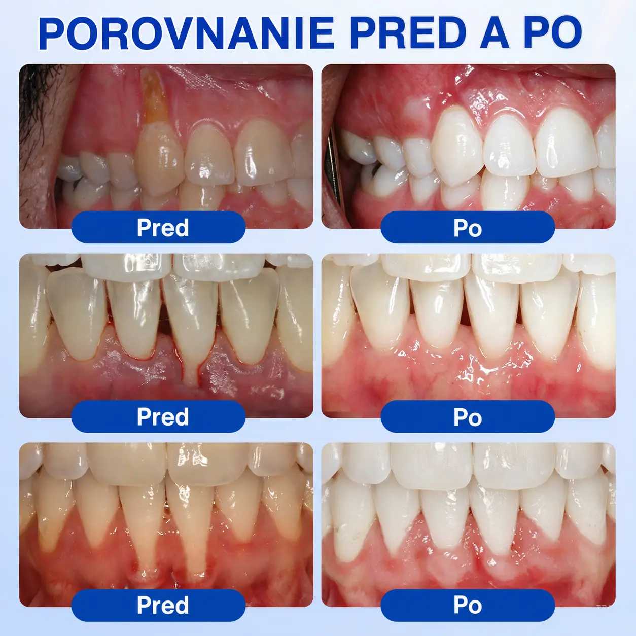 GumRevive Parodontálny opravný gél - Image 3