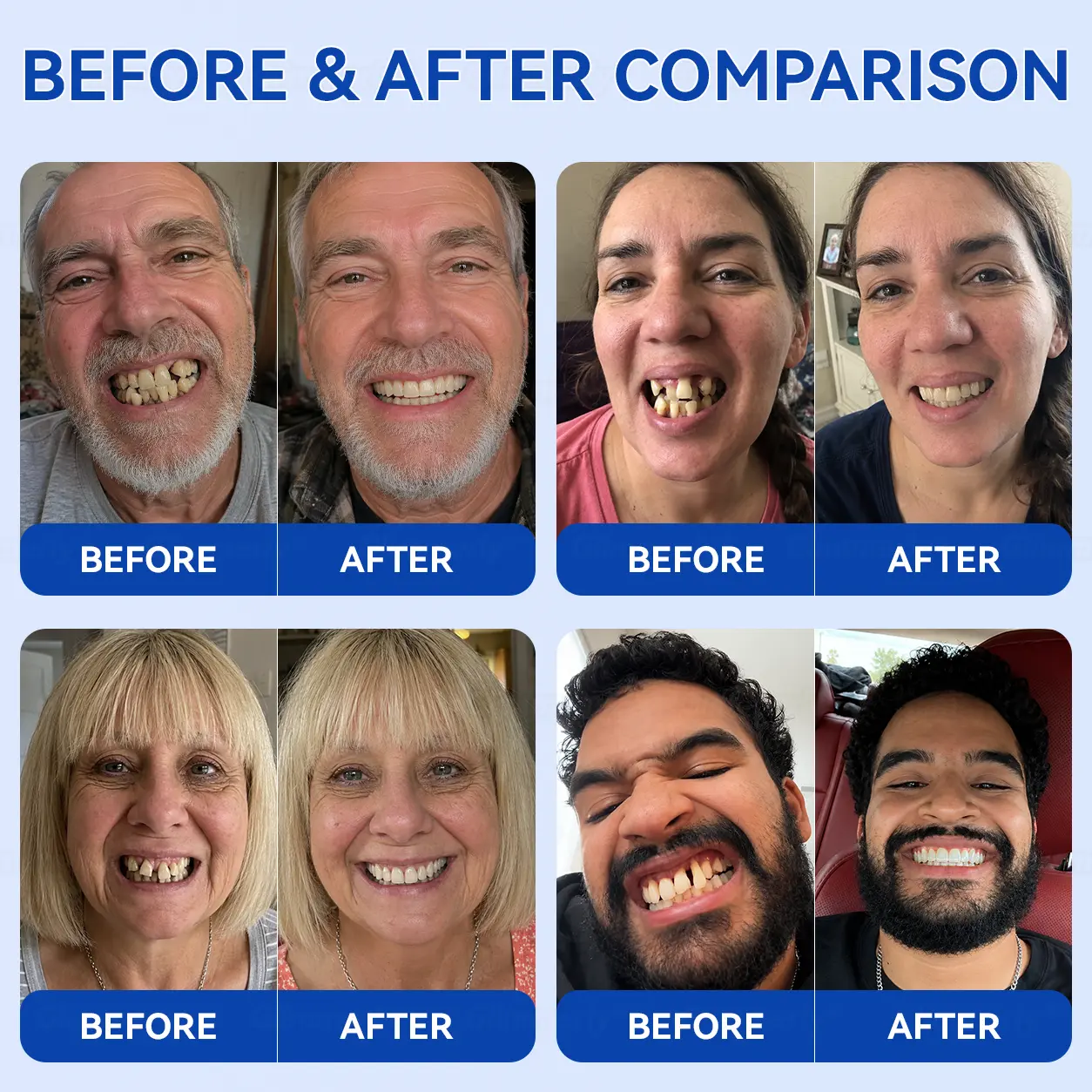 Periodontal Repair Gel - Image 3
