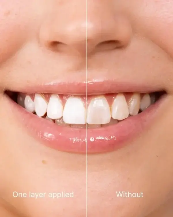 Tooth Polish – Instant White Smile - Image 3