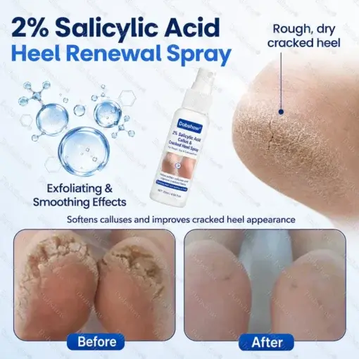 Medical-Grade 2% Salicylic Acid Callus & Cracked Heel Repair Spray - Image 7