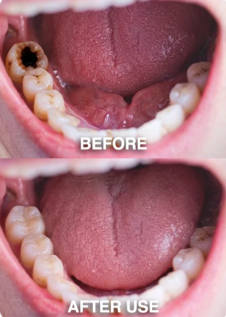 DenPerm Cavity-Repair Natural Enamel Filling Gel - Image 5