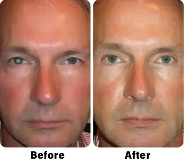 Nano Vision Repair Eye Serum - Image 11