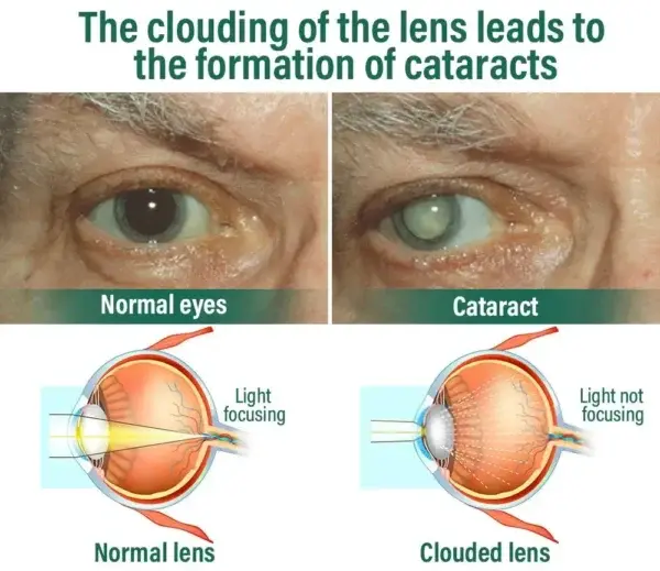 Nano Vision Repair Eye Serum - Image 14