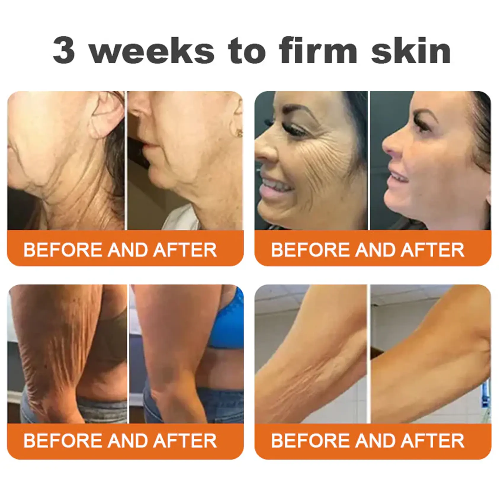 Bee venom Pro Comprehensive Cream—Tightening for Skin Types - Image 4