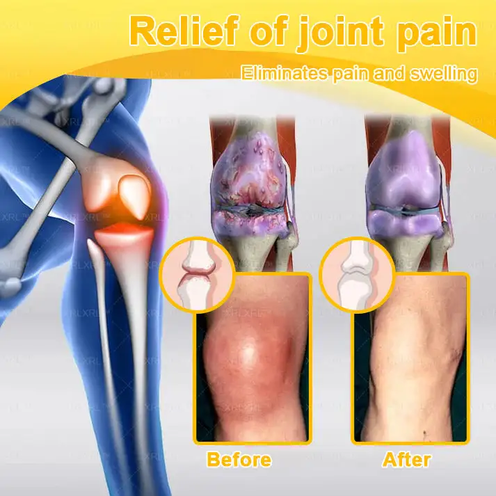 💞💞 Bee Venom Pain-Relief Bone Healing Cream - Image 10