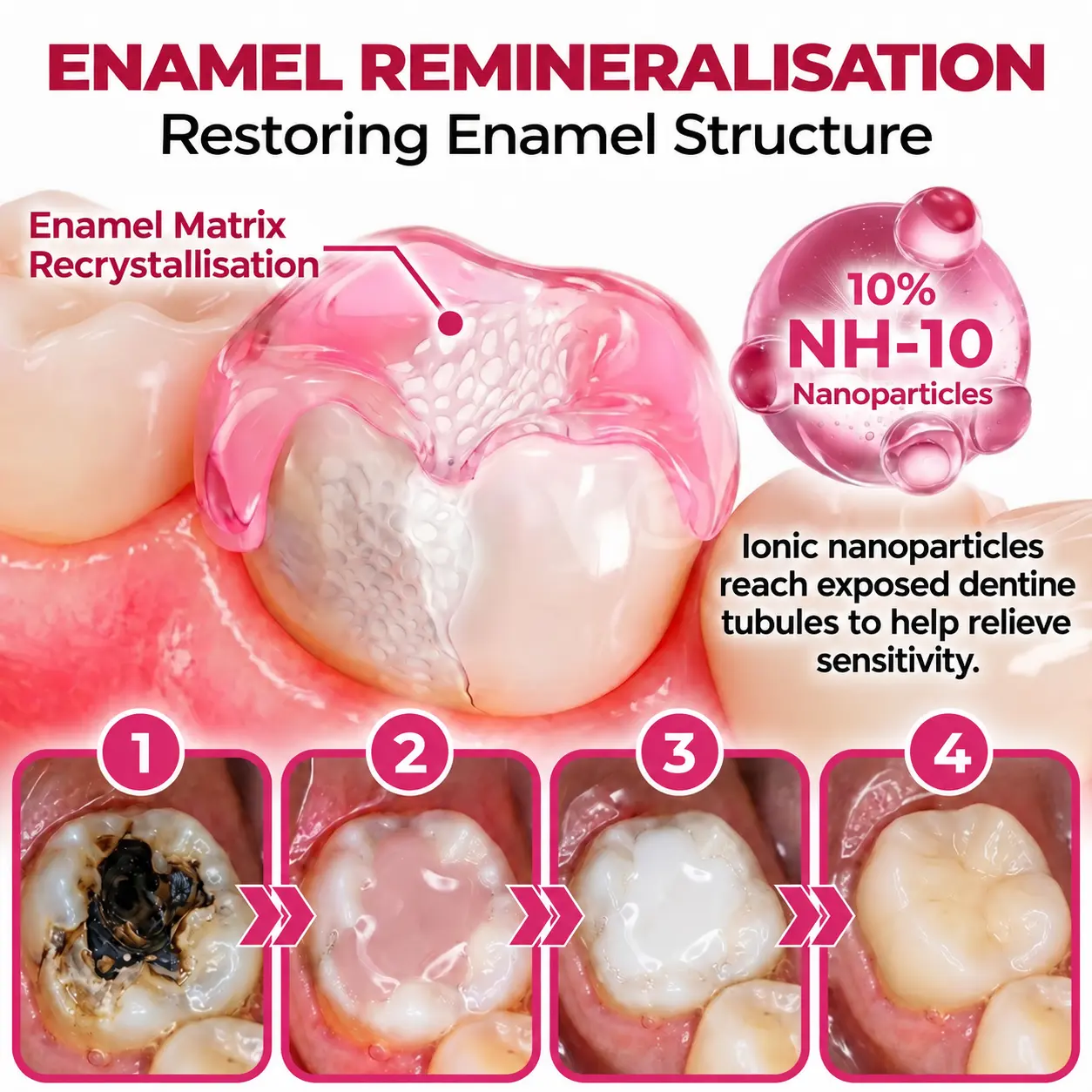 DenPerm – Natural Enamel Repair & Cavity Filling Gel - Image 4