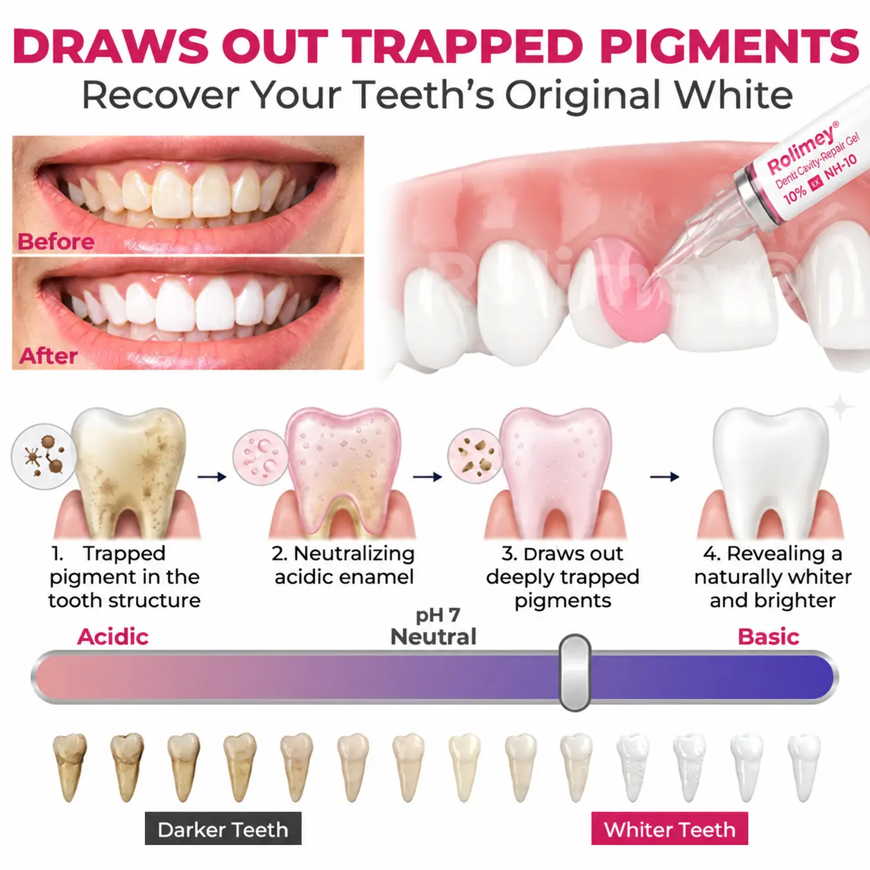DenPerm – Natural Enamel Repair & Cavity Filling Gel - Image 5
