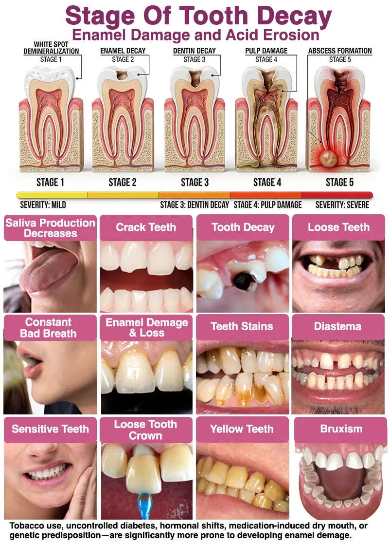DenPerm – Natural Enamel Repair & Cavity Filling Gel - Image 9